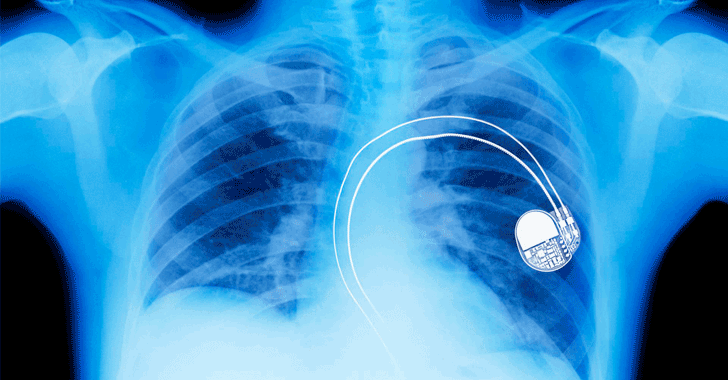 FDA Recalls Nearly Half a Million Pacemakers Over Hacking Fears