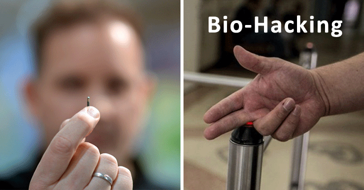 Doctor Implanted 6 MicroChips Under His Skin to Unlock Doors and Secure Data